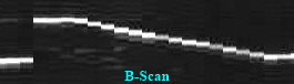 B-Scan